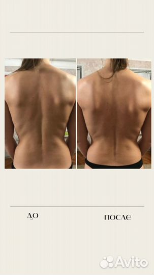 Массаж Лечебный Видное