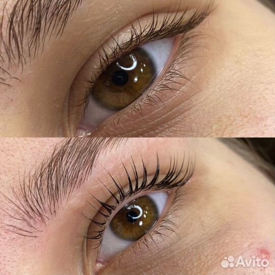 Стрейчинг ресниц