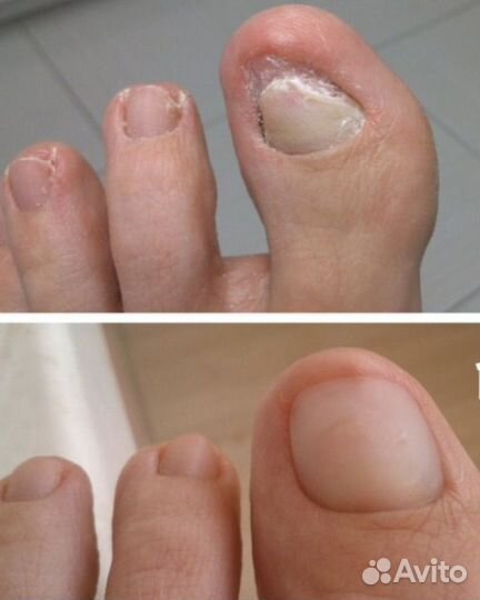 Подолог педикюр