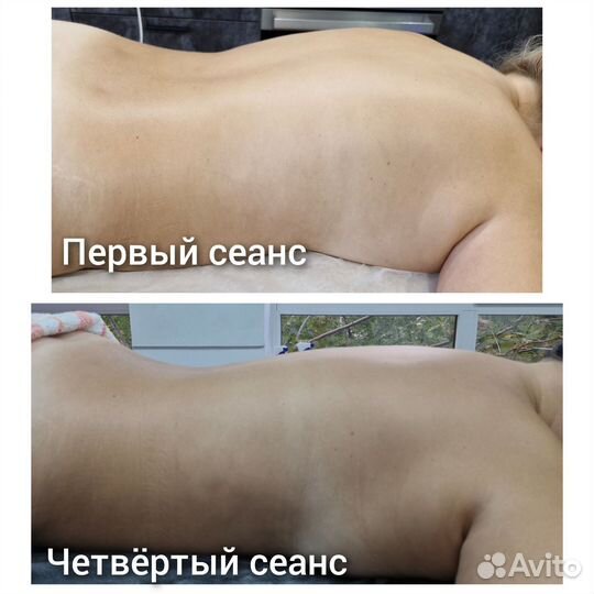 Аппаратный массаж