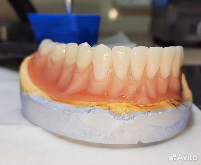 Изготовление съёмного протеза