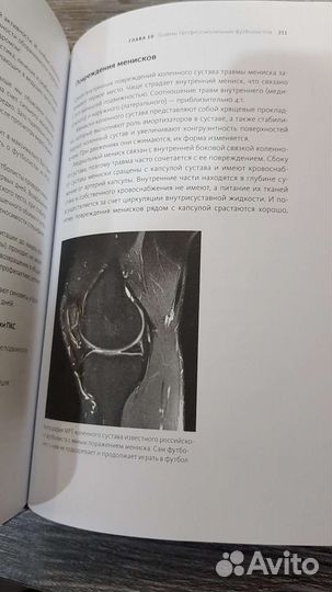 Книга Про Футбол (футбол больше, чем спорт)