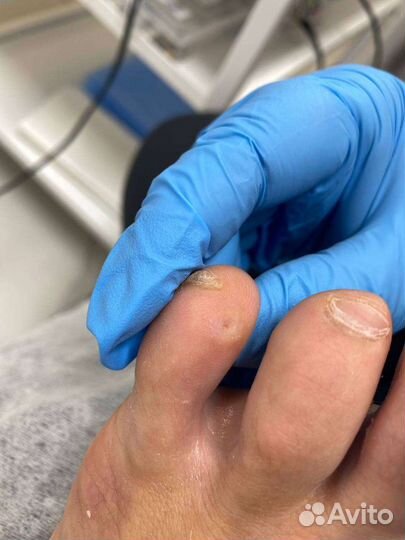 Медицинский педикюр-подолог. Маникюр