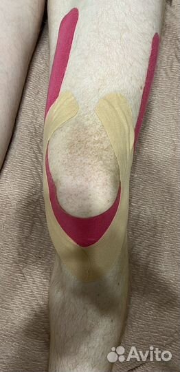 Тейпирование