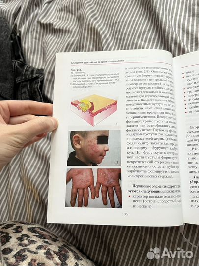 Аллергия у детей - от теории к практике