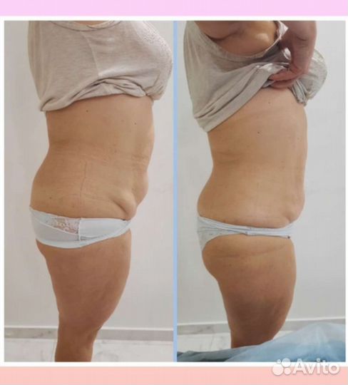 Жиротоп микровейв