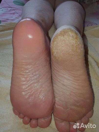 Подология,шугаринг, маникюр