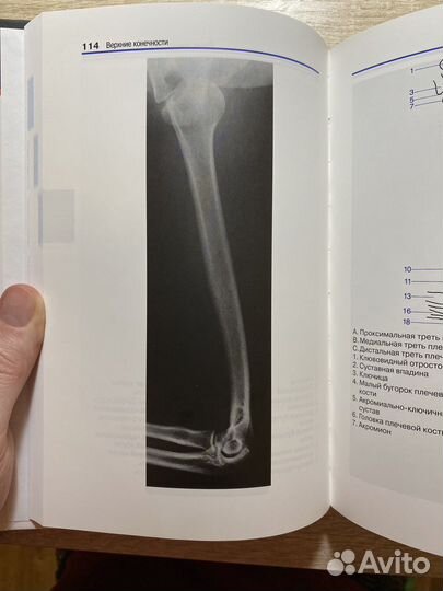 Атлас рентгенологической анатомии