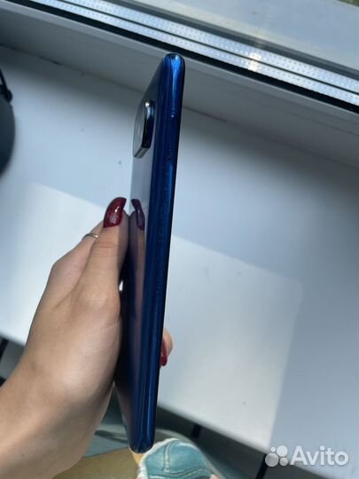 Телефон xiaomi poco x3