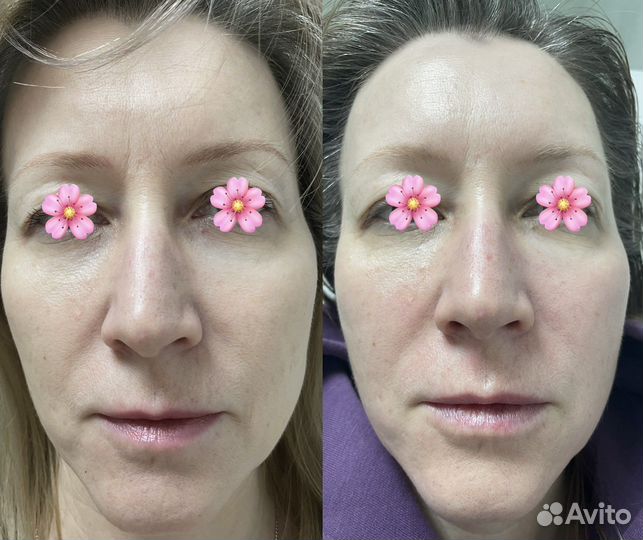 Массаж лица и тела только женщинам