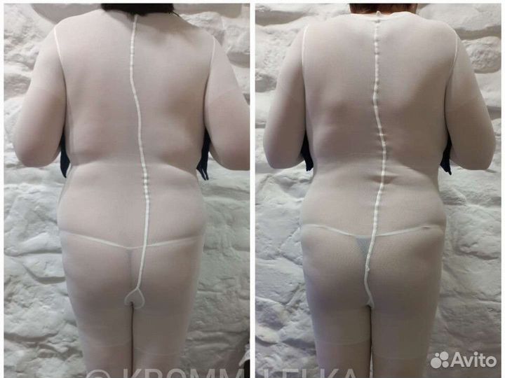Коррекция фигуры
