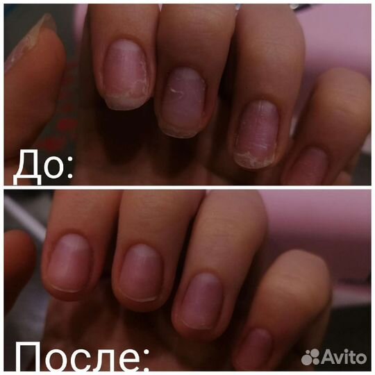 Наращивание ногтей