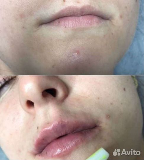 Услуги косметолога