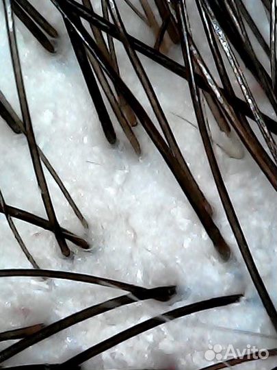 Спа пилинг для кожи головы