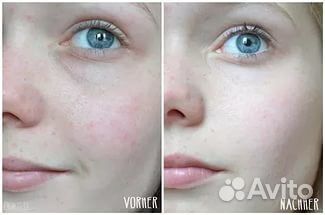 Clarisonic mia 2 usa оригинал