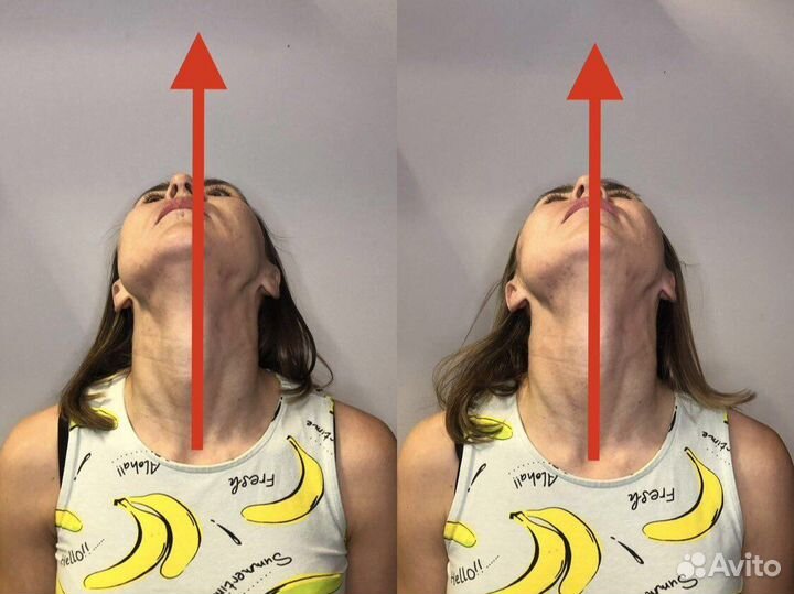 Массаж лица и головы миофасциальный