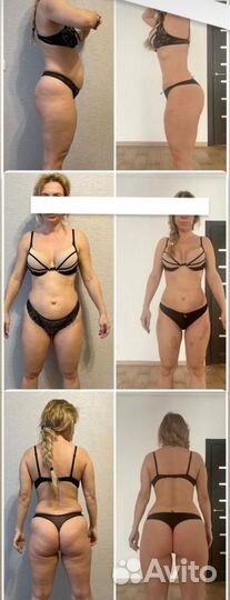 Массаж аппаратный, ручной для похудения