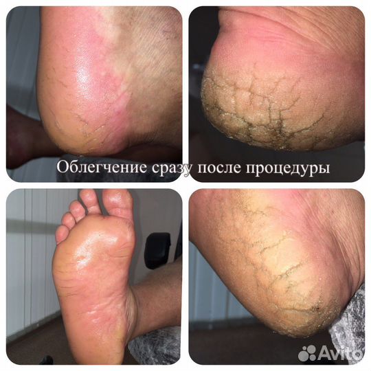 Специалист Подолог, педикюр, маникюр