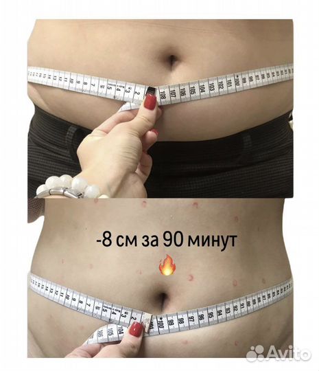 Антицеллюлитный массаж, lpg, похудение, эпиляция л