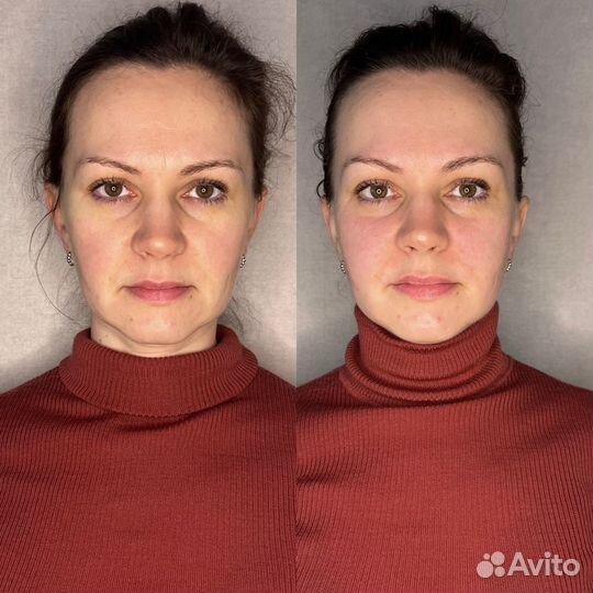 Миофасциальный массаж+Буккальный массаж