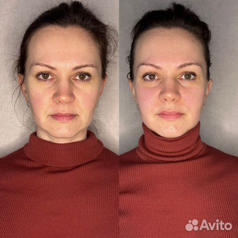 Миофасциальный массаж+Буккальный массаж