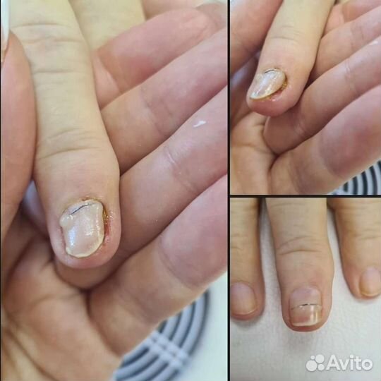 Подология И эстетика