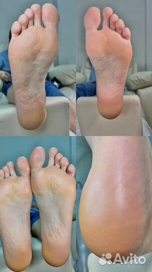 Смарт педикюр, педикюр, SMART, аврора, мастер