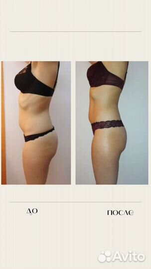 Массаж Лечебный Видное