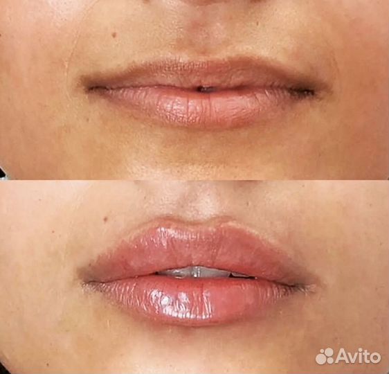 Косметолог эстетист резюме