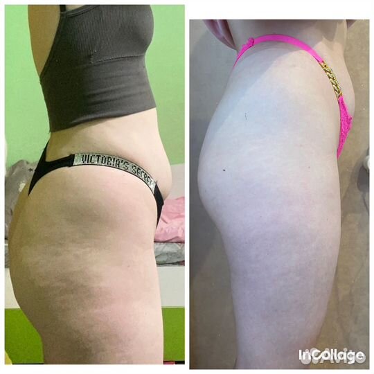 Похудение, коррекция фигуры, тейпирование тела