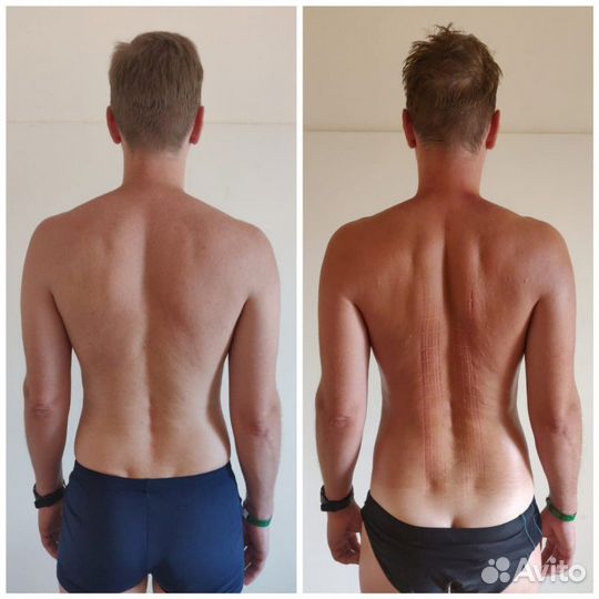 Профессиональный массаж