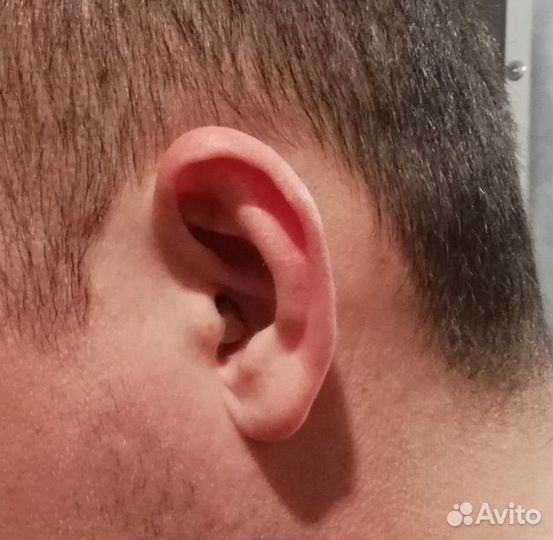 Микронаушник