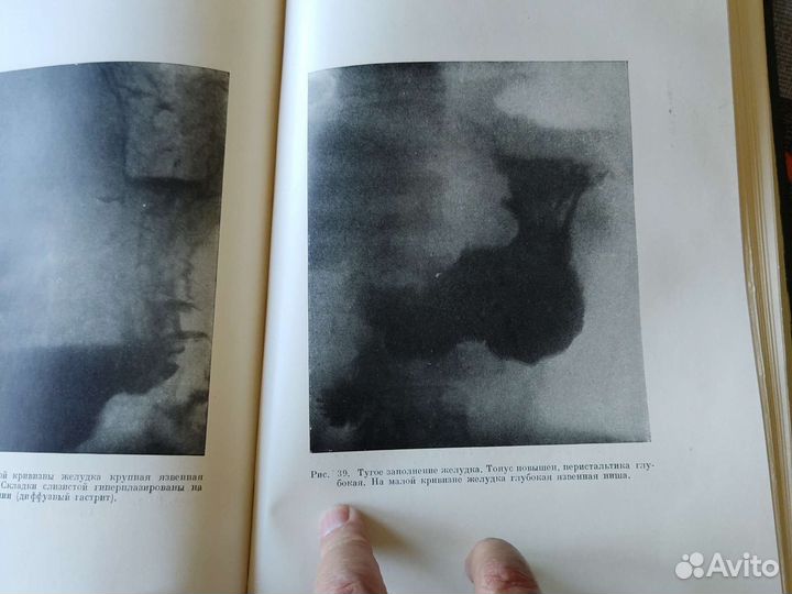 Опыт Советской медицины в ВОВ 1950 год