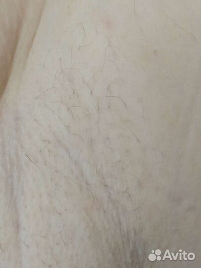 Шугаринг, электроэпиляция, лазерная эпиляция