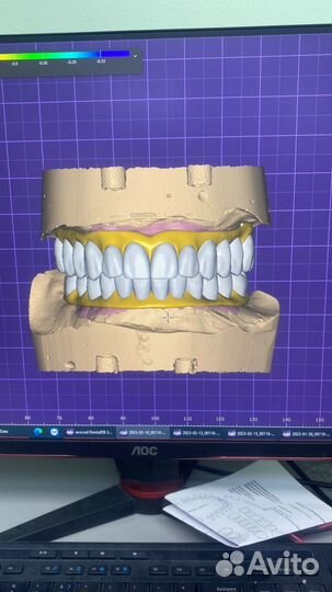 Exocad программа 3.1 Оригинал