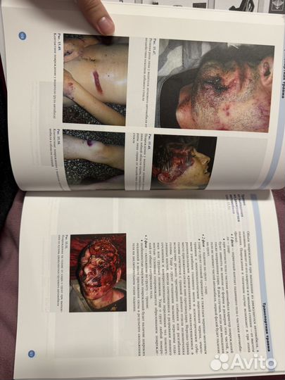 Атлас по судебной медицине Ю. И. Пиголкина