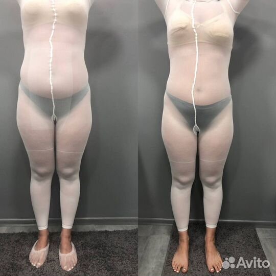 Аппаратный массаж, LPG, коррекция фигуры