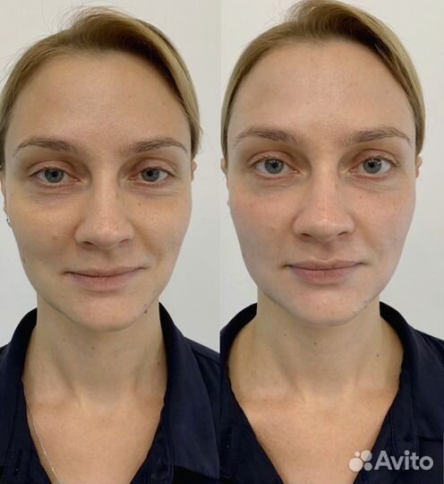 Массаж лица