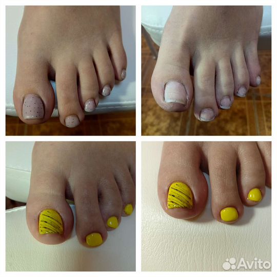 Смарт педикюр