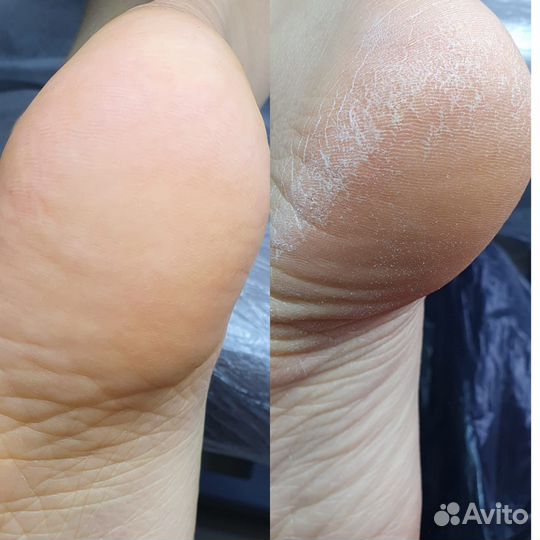 Мастер маникюра и педикюра (SMART педекюр)