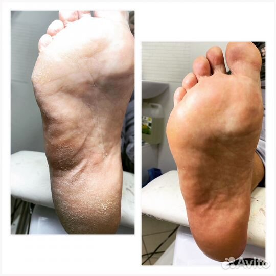 Мастер маникюра