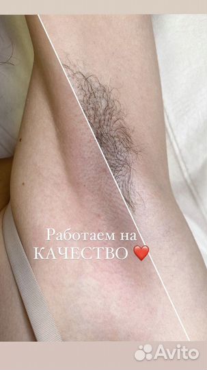 Шугаринг Депиляция Небуг