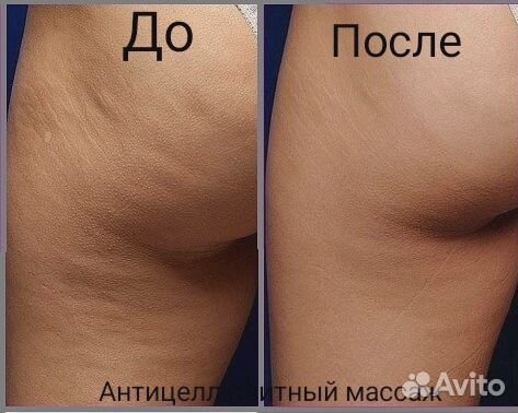 Массаж Елена