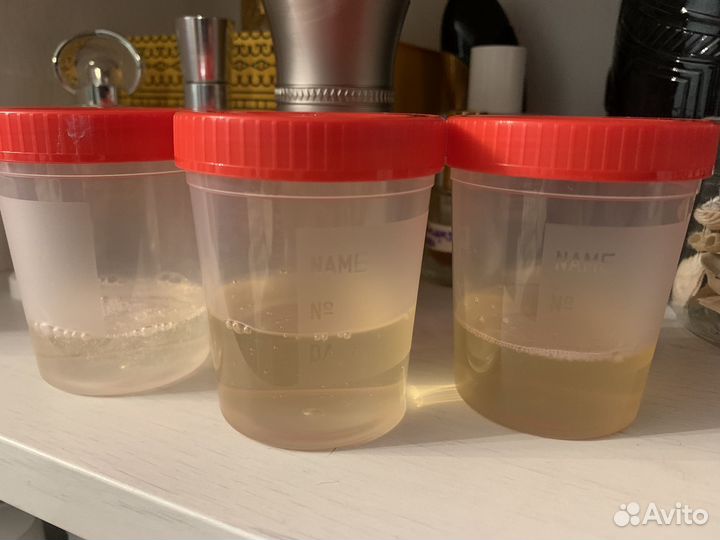 Отливанты шампуня