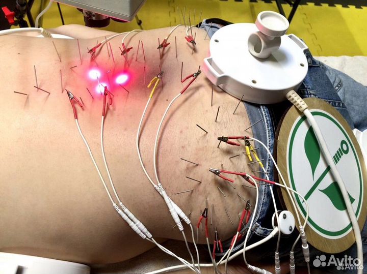 Лечение грыжи позвоночника