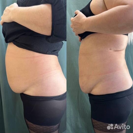 Худеем за неделю