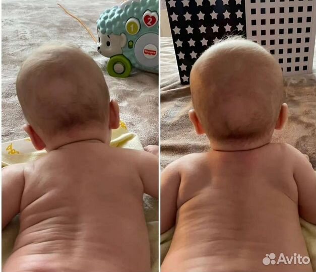 Детский массаж