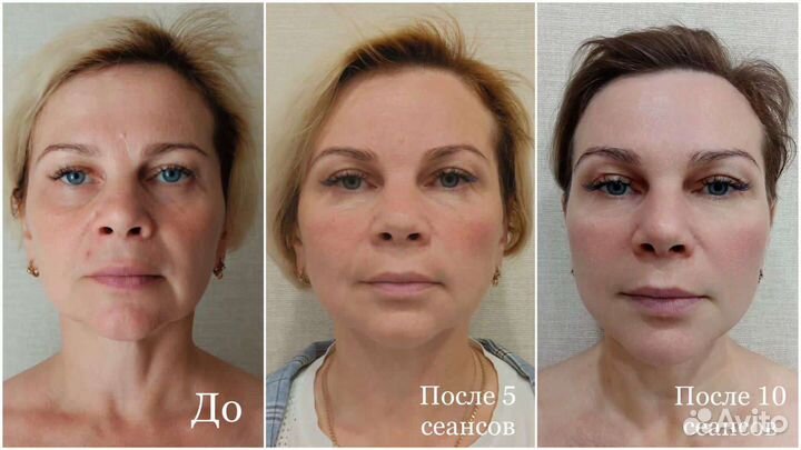 Глубинный скульптурно-буккальный Массаж лица за