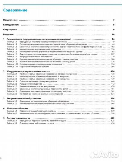 Магнитно-резонансная томография Нейровизуализация