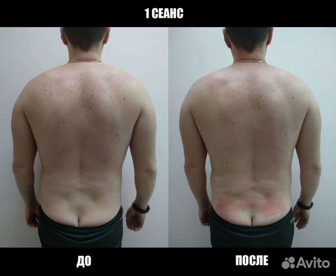 Костоправ Иваново